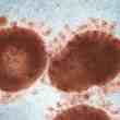 argentina caspr coronavirus