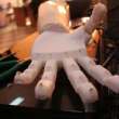 prothesia wins online pioneer competition with 3d printed medical solution