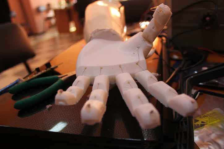 prothesia wins online pioneer competition with 3d printed medical solution